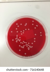 222 Klebsiella Pneumoniae Stock Photos, Images & Photography | Shutterstock