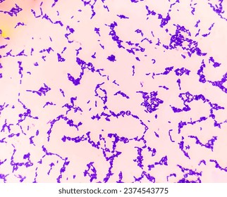 Klebsiella pneumoniae from colonies gram stained analyzed by microscope.