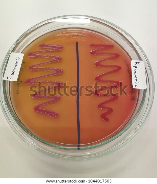 Klebsiella Pneumoniae Enterobacter Aerogenes On Macconkey Stock Photo ...