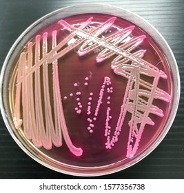 Klebsiella Pneumoniae  On Macconkey Agar