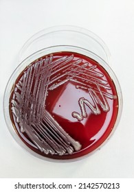 Klebsiella pneumoniae or Klebsiella spp.; bacterial culture growth on Blood agar. top view