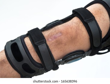 Knee Brace For ACL Football Knee Injury.