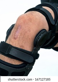 Knee Brace For ACL Football Knee Injury.