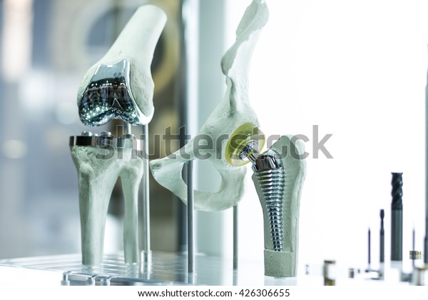 Knee and hip\
prosthesis