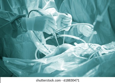 Knee keyhole surgery hospital arthroscopy operation medical procedure in emergency room operating theater.