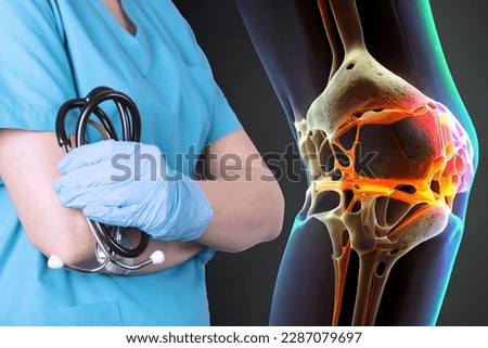 Knee meniscus, knee injury. Advice from a surgeon's doctor. Medical Poster Stock foto © 