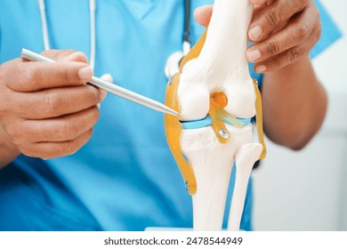 Knee osteoarthritis, Doctor showing model knee joint orthopedic. - Powered by Shutterstock