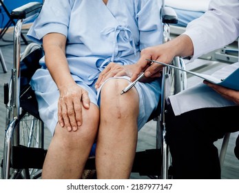 Knee Surgery Scar. Close-up Scars Surgical Total Knee Joint Replacement On Senior Or Elderly Old Lady Woman Patient On Wheelchair Pointing By Pen While Doctor Holding Patient Medical Record File.