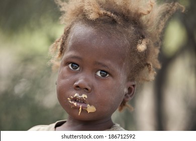 KOLMINY, HAITI - FEBRUARY 12, 2014.  Haitian Toddler Showing Signs Of Malnutrition Eating Peanut Butter Bread Given To Her By Missionaries.