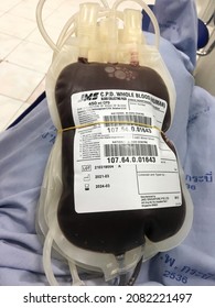 Krabi ,Thailand - October 1st, 2021 : Whole Blood Of Human In Blood Transfusion Bag Will Testing In Laboratory Before Give Tranfusion Blood In Patient