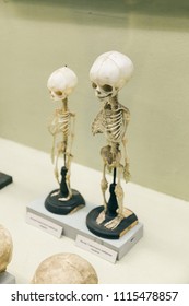 KYIV, UKRAINE - JUNE 16, 2018: National Museum of Natural Sciences of Ukraine. Baby skeleton, dead child. Infant anatomical ribs. Skull bones.