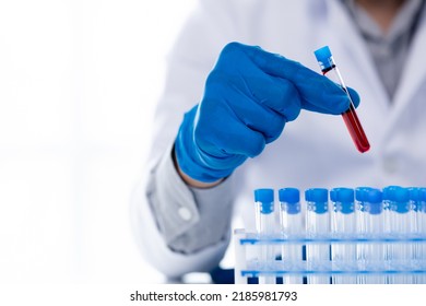 Lab Assistant, A Medical Scientist, A Chemistry Researcher Holds A Glass Tube Through The Blood Sample, Does A Chemical Experiment And Examines A Patient's Blood Sample. Medicine And Research Concept.