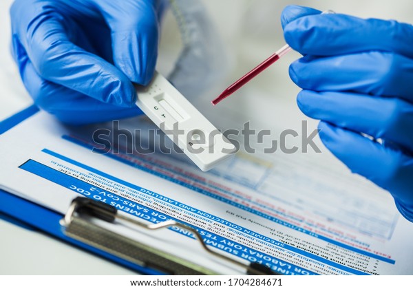 Lab scientist performing rapid diagnostic test
RDT for antibodies to detect presence of viral protein antigens
expressed by COVID-19 corona virus disease,CDC quick fast antibody
point of care testing