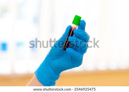 Lab tech with blood sample. A gloved hand presents a sealed blood sample with a green cap, highlighting an essential lab procedure.