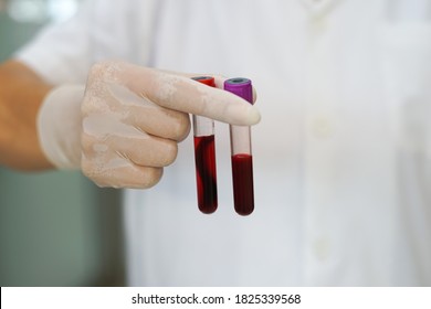 lab technician hands holding difference blood plasma tubes ready for testing , selective focus                      