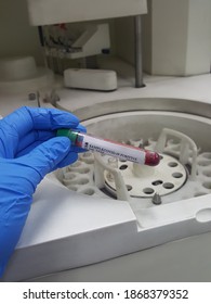 Lab Technician Holding Test Tube With Label COVID-19, Chemistry Analysis Of Recovered Coronavirus Patient Blood Specimen Sample.