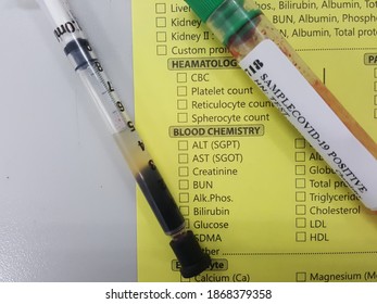 Lab Technician Holding Test Tube With Label COVID-19, Chemistry Analysis Of Recovered Coronavirus Patient Blood Specimen Sample.