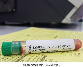 Lab Technician Holding Test Tube With Label COVID-19, Chemistry Analysis Of Recovered Coronavirus Patient Blood Specimen Sample.