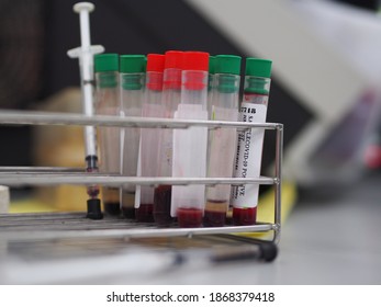 Lab Technician Holding Test Tube With Label COVID-19, Chemistry Analysis Of Recovered Coronavirus Patient Blood Specimen Sample.