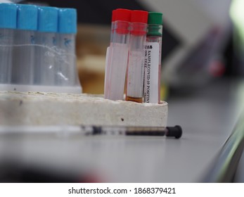 Lab Technician Holding Test Tube With Label COVID-19, Chemistry Analysis Of Recovered Coronavirus Patient Blood Specimen Sample.