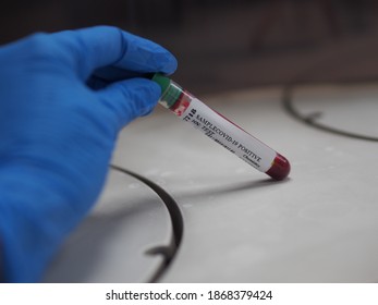 Lab Technician Holding Test Tube With Label COVID-19, Chemistry Analysis Of Recovered Coronavirus Patient Blood Specimen Sample.