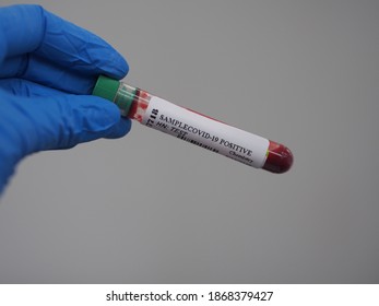 Lab Technician Holding Test Tube With Label COVID-19, Chemistry Analysis Of Recovered Coronavirus Patient Blood Specimen Sample.