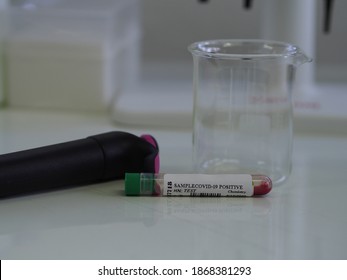 Lab Technician Holding Test Tube With Label COVID-19, Chemistry Analysis Of Recovered Coronavirus Patient Blood Specimen Sample.