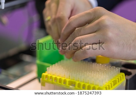 The lab technician puts the sample in the Autosampler automatic sampling device. High-tech in the laboratory