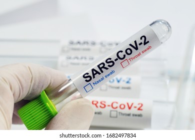 The lab technician shows a vial with a nasal or throat swab. COVID -19 (SARS CoV-2). Tests for the presence of coronavirus in the body. 