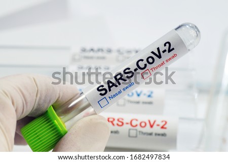The lab technician shows a vial with a nasal or throat swab. COVID -19 (SARS CoV-2). Tests for the presence of coronavirus in the body. 