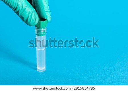 A lab technician's hand tightens the cap on a test tube containing biological material. Stool analysis for salmonella and protozoan parasites.