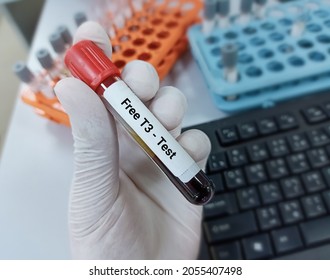 Lab Technologist hold blood sample for Free T3 test. Laboratory medical testing concept. Blood sample for thyroid  testing. 