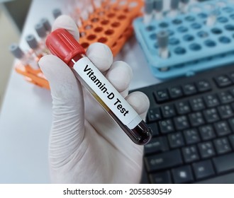 Lab Technologist Hold Blood Sample For Vitamin -D Test. Laboratory Medical Testing Concept. 