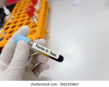 Lab Technologist Hold Blood Sample For Factor II- Test. Laboratory Medical Testing Concept. 