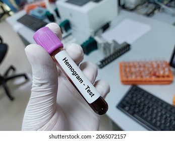 Lab Technologist Hold Blood Sample For Hemogram  Test. Laboratory Medical Testing Concept. 