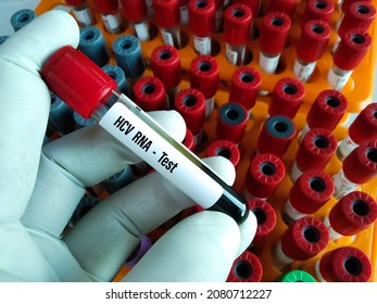 Lab Technologist Hold Blood Sample For PCR HCV RNA Test. Laboratory Medical Testing Concept.