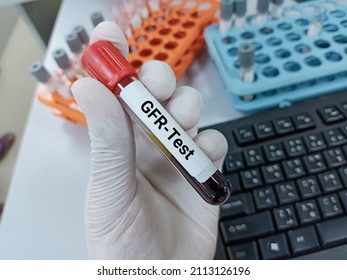 Lab Technologist Hold Blood Sample For GFR Test. Laboratory Medical Testing Concept. 