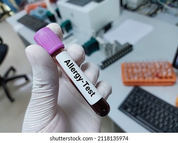 Lab Technologist Hold Blood Sample For Allergy Test. Laboratory Medical Testing Concept. 