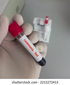 Lab Technologist Hold Blood Sample For Leishmania Test. Laboratory Medical Testing Concept.