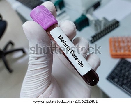 Lab Technologist hold blood sample for  Malaria Parasite test. Laboratory medical testing concept. 