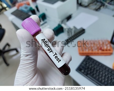 Lab Technologist hold blood sample for Allergy test. Laboratory medical testing concept. 