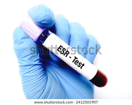 Lab Technologist hold blood sample for ESR test. Blood sample for erythrocyte sedimentation rate (ESR) test. Isolated On White Background.
