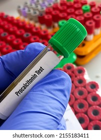 Lab Technologist Holds Blood Sample For Procalcitonin (PCT) Test, Diagnosis Of Severe Sepsis.