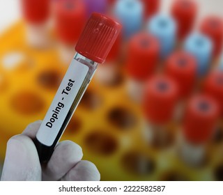 Lab Technologist Holds Blood Sample For Doping Test With Laboratory Background.