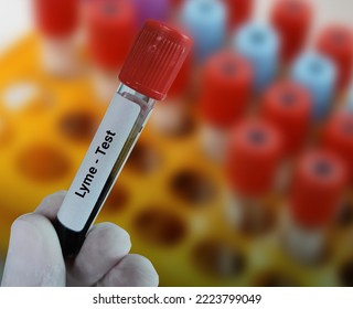 Lab Technologist Holds Blood Sample For Lyme Disease Test With Laboratory Background.