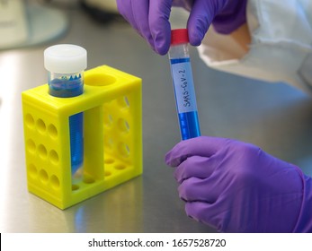 Lab Worker, Laboratory Testing, Sars-CoV-19, Test Tubes, Laboratory Gloves, PCR, ELISA.