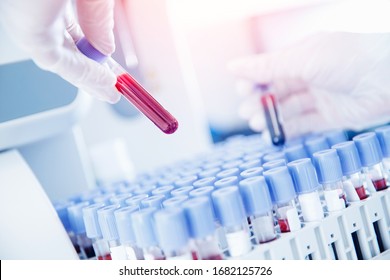 Lab Worker Preparing Test Blood For Detection Of Antibodies And Infections Corona Virus.