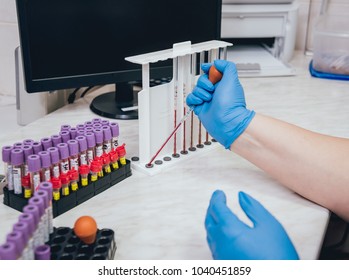 Laboratory Assistant Conducts A Blood Test. Medical Equipment