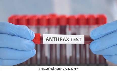 Laboratory Assistant Wearing Protection Gloves Holds Vial With Anthrax Test