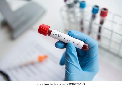 Laboratory Blood Sample Positive Hpv Human Stock Photo 2208926439 ...